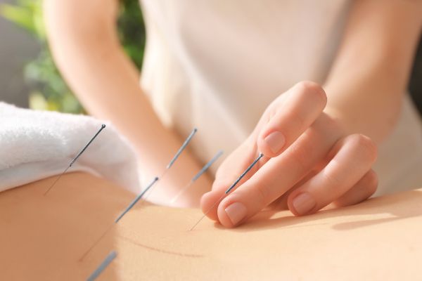 The efficacy of acupuncture treatment